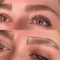 فیبروز میکرو