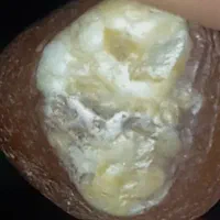 مهر قدیمی