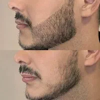 کاشت‌ممنوع