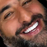 دندانپزشکی لبخند با تعرفه دولتی