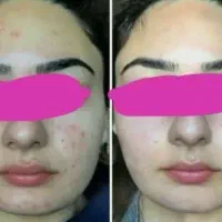 جشنواره ویژه تخصصی فیشال ففط فقط تا اول مهرماه|خدمات آرایشگری و زیبایی|تهران, مدائن|دیوار