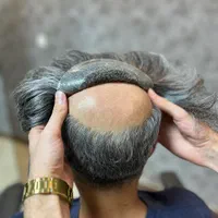 خدمات کامل پروتز مو و تعویض چسب در شهرک غرب