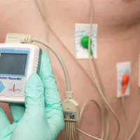 اجاره هولتر ریتم قلب و سایر تجهیزات پزشکی در منزل|پزشکی|مشهد, هنرور|دیوار