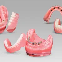 دندانسازی و ایمپلنت|خدمات آرایشگری و زیبایی|تهران, شادمان|دیوار