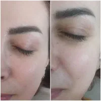 مدل فیشیال تخصصی هزینه مواد گرفته میشود