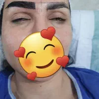 تخفیفات ویژه تابستانه کاشتمو ابرو مژه تخصصی|خدمات زیبایی و سلامت|کرمانشاه, |دیوار