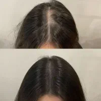 این اقدام آخریشه