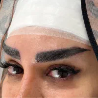 کاشت ابرو در قم و تهران