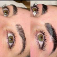 لیفت انجام بده و بوتاکس تراپی از من هدیه بگیر|خدمات آرایشگری و زیبایی|امیدیه, |دیوار