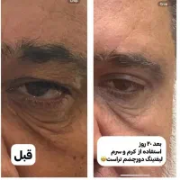 سارا محمدپور هستم|آرایشی، بهداشتی، درمانی|تهران, آزادشهر|دیوار