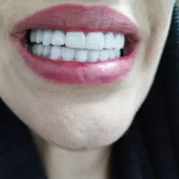 دفترچه دندانپزشکی پارسیان بگیرید