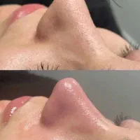پاکسازی و فیشال پوست تخصصی بانوان رشت|خدمات آرایشگری و زیبایی|رشت, گلباغ نماز|دیوار