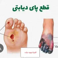 دیابت درمان شد(یک هفته ای قندتو بیار زیر ۱۰۰)|خدمات آرایشگری و زیبایی|مشهد, هفده شهریور|دیوار