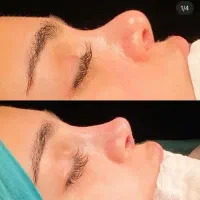 عمل جراحی بینی،لیفت صورت،گوش،اندام|خدمات زیبایی و سلامت|تهران, فلاح|دیوار