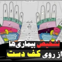 تشخیص بیماری ها از کف دست