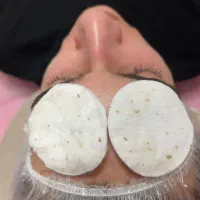 برداشتن انواع خال گوشتی،زگیل،منگوله،کک مک|خدمات آرایشگری و زیبایی|شیراز, شهرک امیر کبیر|دیوار