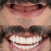 وام دندانپزشکی دکتر اسلامی فر|خدمات آرایشگری و زیبایی|ساوه, |دیوار