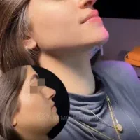 جشنواره فول فیس توسط پزشک متخصص|خدمات آرایشگری و زیبایی|تهران, ونک|دیوار