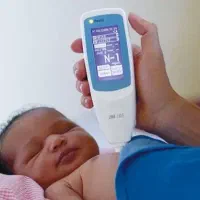 تست زردی نوزاد با بیلیچک در منزل - بدون خونگیری