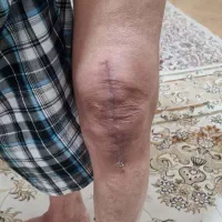 خدمات تخصصی فیزیوتراپی در منزل شیراز|خدمات آرایشگری و زیبایی|شیراز, زرهی|دیوار