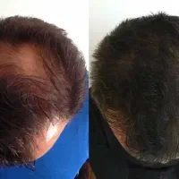 پرپشت کردن موهات کارسختی نیست