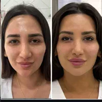 کلینیک تخصصی ژل و فیلر،لیپو و..|خدمات آرایشگری و زیبایی|شهریار, شهریار|دیوار