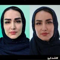 ترانسفر خدمات و جراحی زیبایی
