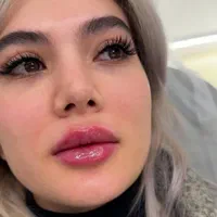 ژل لب بوتاکس فیلر انزیم ساکشن غبغب گونه زاویه سازی|خدمات آرایشگری و زیبایی|مشهد, سجاد شهر|دیوار