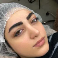 میکروبلیدینگ فیبروز نچرال بروز