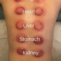 بادکش گرم و آگنی کارما.|خدمات آرایشگری و زیبایی|تهران, بهارستان|دیوار