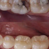 دندون|پزشکی|قزوین, |دیوار