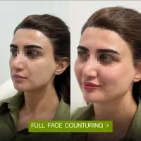 معمـاری صـورت و خلـق لب روسـی/مطب تخصصی پوست و مو