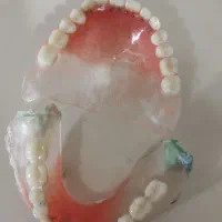 دندانسازی صدف کاوه