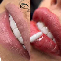 میکروبلیدینگ و شیدینگ|خدمات آرایشگری و زیبایی|تهران, حکیمیه|دیوار