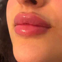 خدمات ژل فیلر بوتاکس|خدمات آرایشگری و زیبایی|هشتگرد, هشتگرد قدیم|دیوار