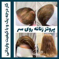 پروتزمو (دکترپروتز)