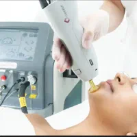 دستگاه شاتی کندلا با سه اسپات سایز