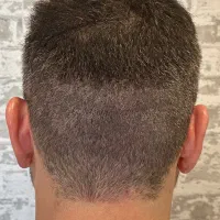 پرپشتی مو در سه روز بدون کاشتمو|خدمات آرایشگری و زیبایی|جهرم, |دیوار