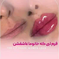 تزریق ژل‌فیلر،لب،گونه‌(جشنواره یلدا)درمطب فقط499ت