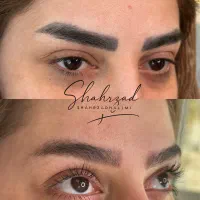 اجاره ورنت لیزر کیوسوییچپیکوشور بااپراتور حرفه ای|پزشکی|تهران, اقدسیه|دیوار