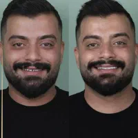 دندانپزشکی دیبا شیراز، قصرالدشت