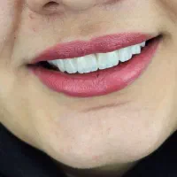 مطب دندانپزشکی طرف قرارداد با بیمه های تکمیلی