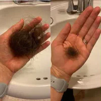 از جمع کچلا بیا بیرون