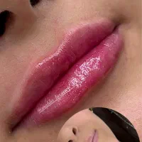 تزریق ژل و بوتاکس اف تا فردافقط۹۸۰|خدمات آرایشگری و زیبایی|یاسوج, |دیوار