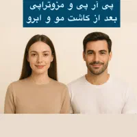 پی آر پی مو و صورت تخفیف ویژه پی ارپی بعدازکاشت مو|خدمات آرایشگری و زیبایی|قزوین, |دیوار