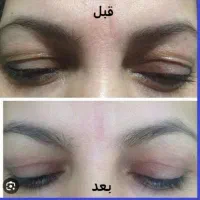 انجام خدمات پلکسر  بابهترین کیفیت و کمترین هزینه