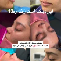 اف زیبایی بینی و لیپو|خدمات آرایشگری و زیبایی|اهواز, کیانپارس |دیوار
