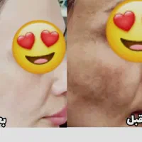 چند منظوره تخصصی ضدلک