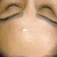 فیشیال تخصصی صورت|خدمات آرایشگری و زیبایی|قم, صدوق|دیوار