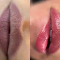 شیدینگ لب با ۲۰ درصد تخفیف